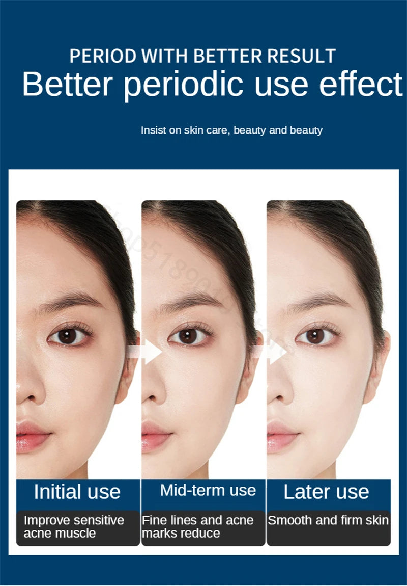 Facial Repair Lyophilized Powder Set Shrink Pore Moisturizing Anti-Wrinkle Anti Aging Whiten Peptide Nicotinamide Brighten Serum