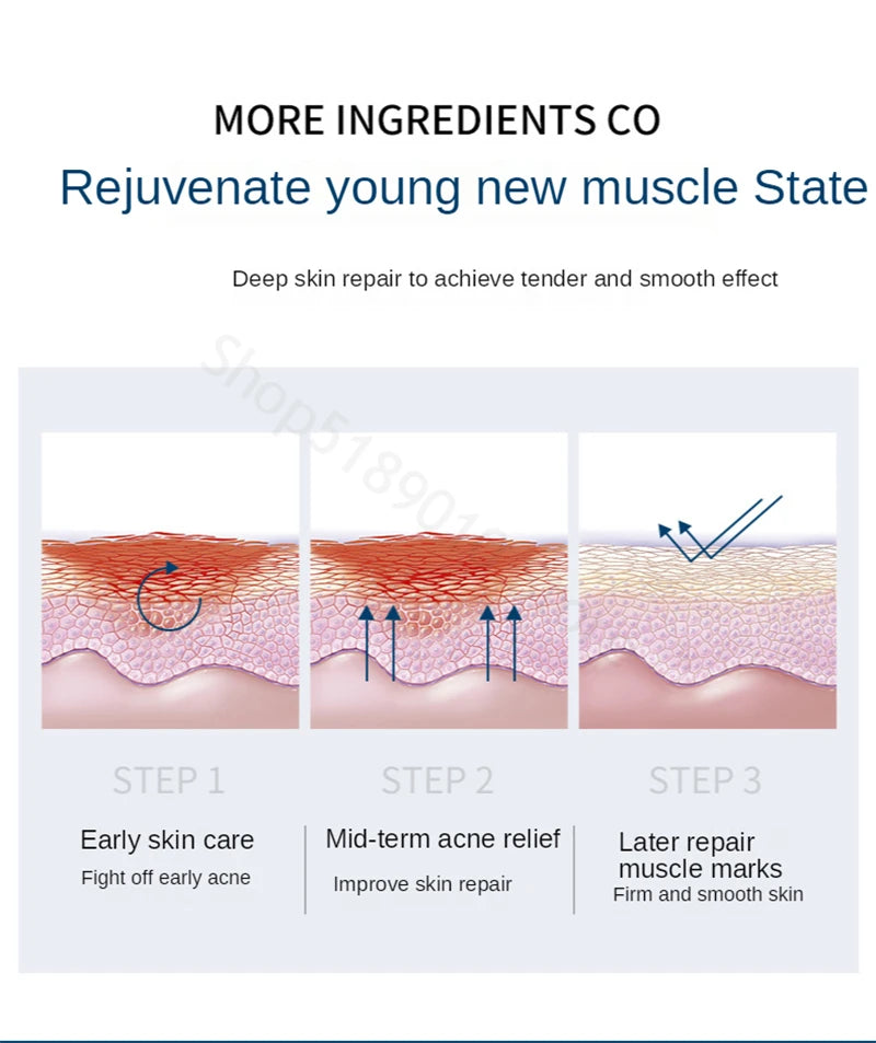 Facial Repair Lyophilized Powder Set Shrink Pore Moisturizing Anti-Wrinkle Anti Aging Whiten Peptide Nicotinamide Brighten Serum