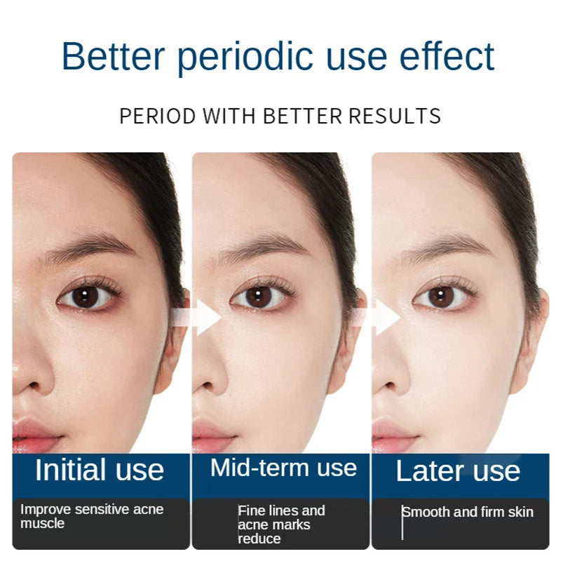 Facial Repair Lyophilized Powder Set Shrink Pore Moisturizing Anti-Wrinkle Anti Aging Whiten Peptide Nicotinamide Brighten Serum