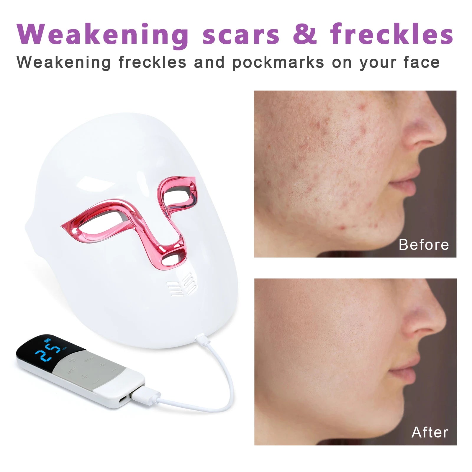 USB Standing Face Therapy Red Light Facial Mask Household Infrared Skin Whitening Wrinkle Remover for Acne Treatment Led Mask