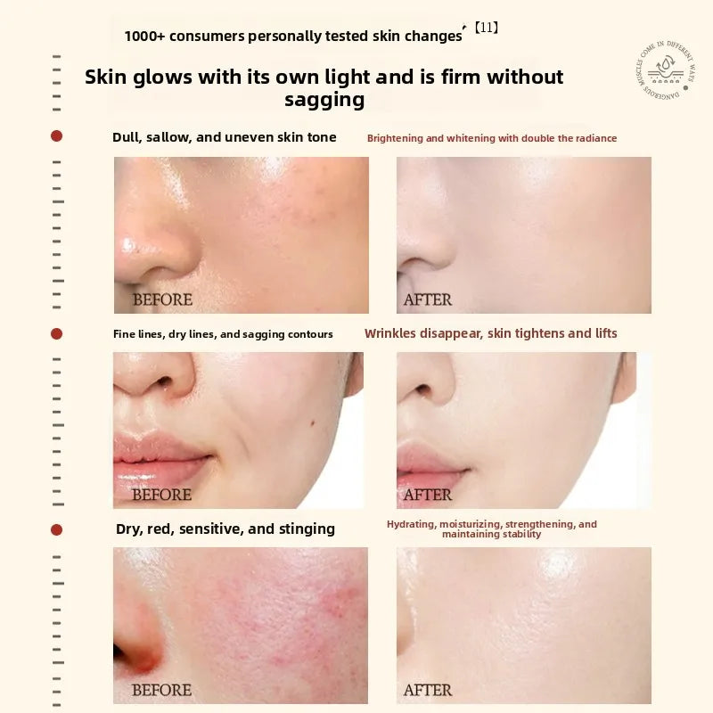 RUYI Astaxanthin Face Care Lotion Set Brighten Skin Tone Facial Clean Whiten Moisturizing Hydrating Yellowish Complexion Removal