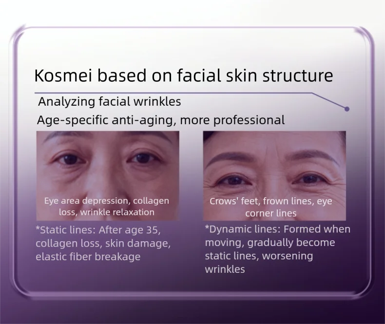 CASMA Microneedle Essence Care Set - Eye Brightening & Wrinkle Freezing Patches,Dark Circles,Fine Lines, Puffiness & Anti-Aging